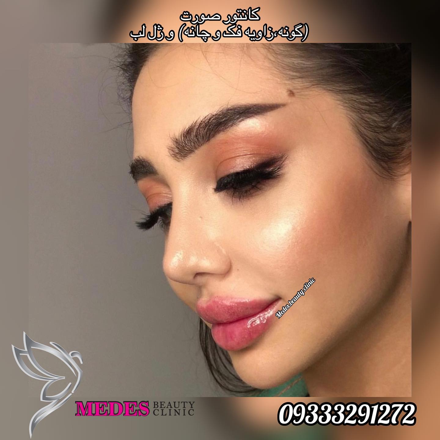 گالری زاویه سازی صورت